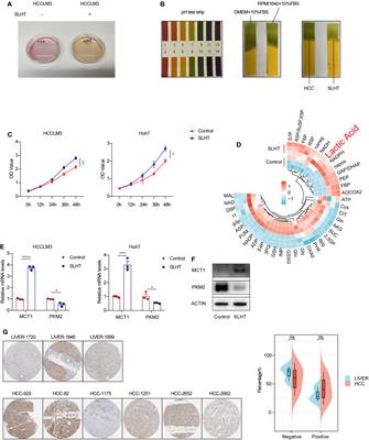 Sublethal heat treatment enhances lactic acid uptake in macrophages via MCT1, leading to reduced paraspeckle formation and a subsequent decrease in macrophage pyroptosis